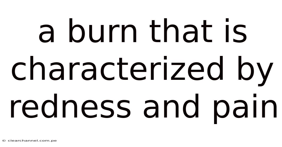 A Burn That Is Characterized By Redness And Pain