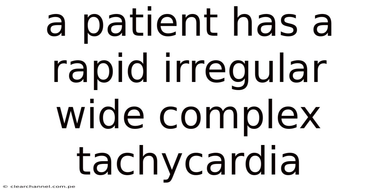 A Patient Has A Rapid Irregular Wide Complex Tachycardia