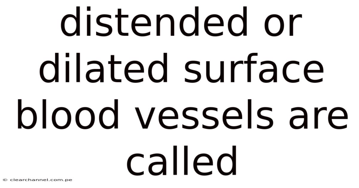 Distended Or Dilated Surface Blood Vessels Are Called