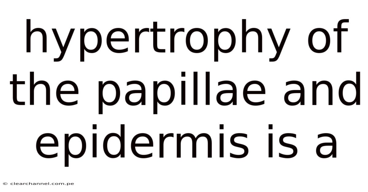 Hypertrophy Of The Papillae And Epidermis Is A