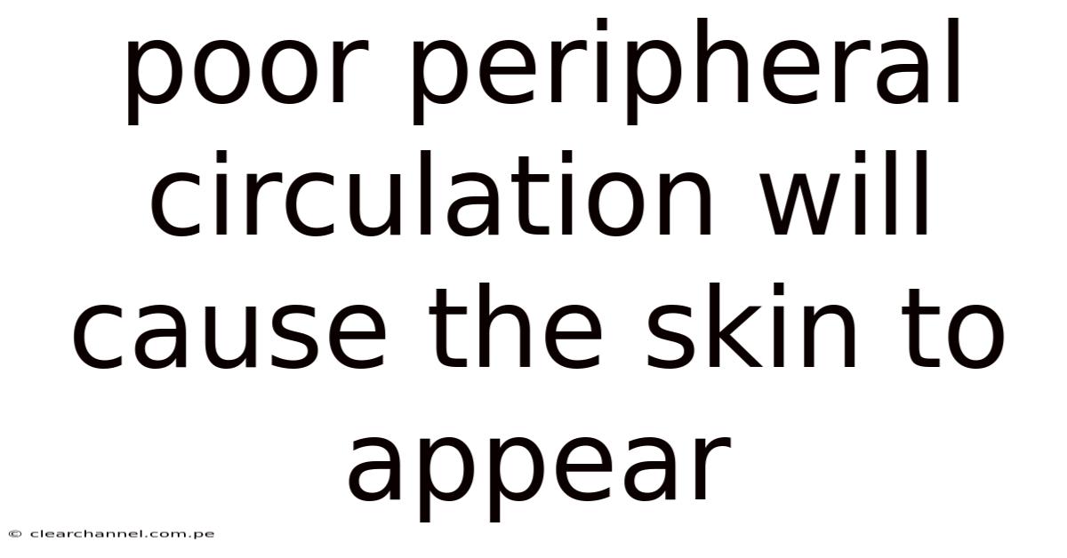 Poor Peripheral Circulation Will Cause The Skin To Appear