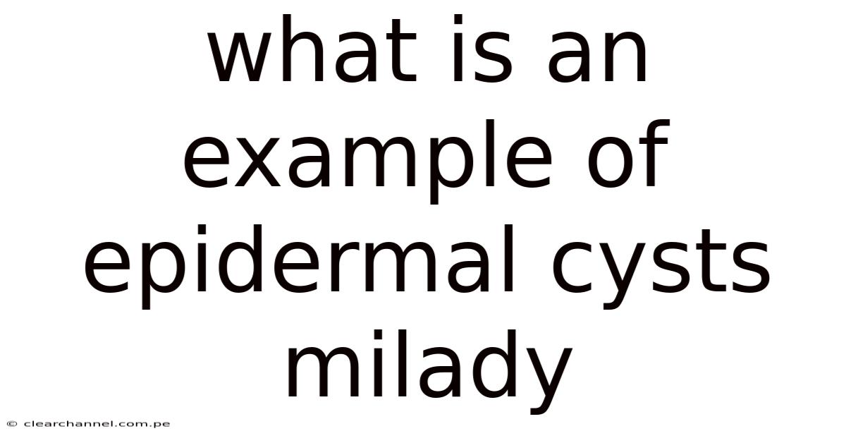 What Is An Example Of Epidermal Cysts Milady
