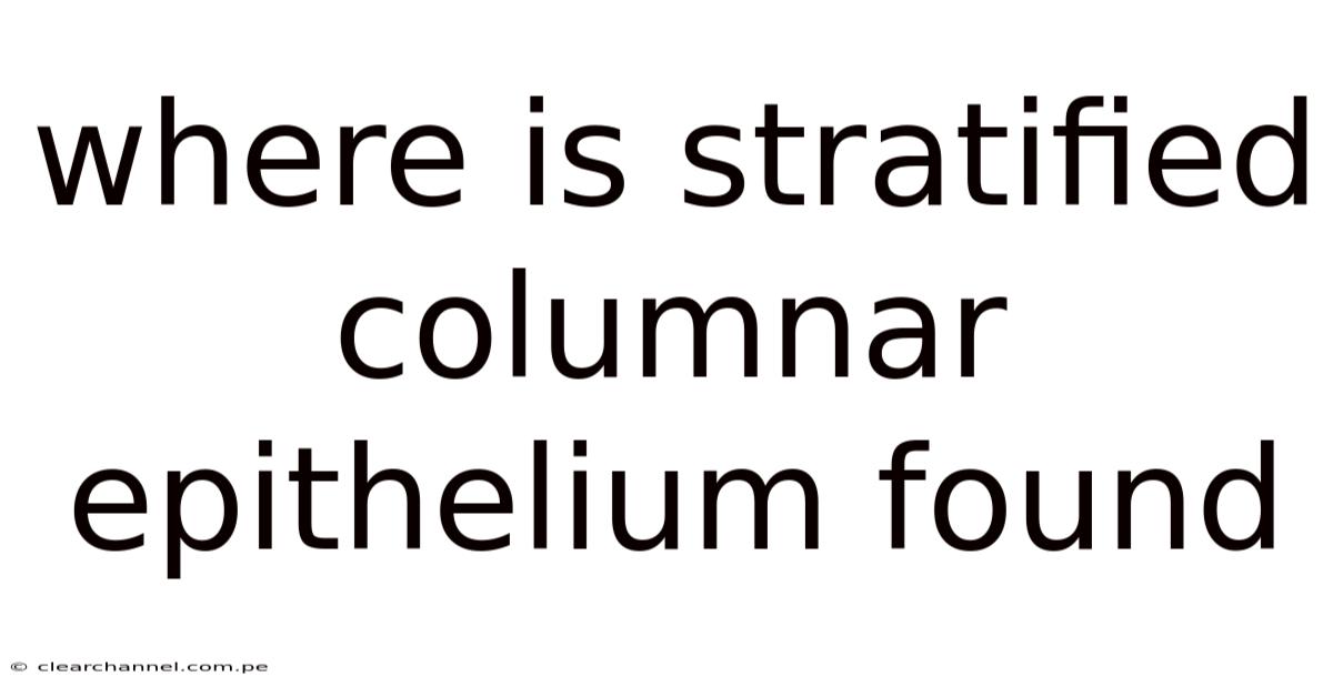 Where Is Stratified Columnar Epithelium Found