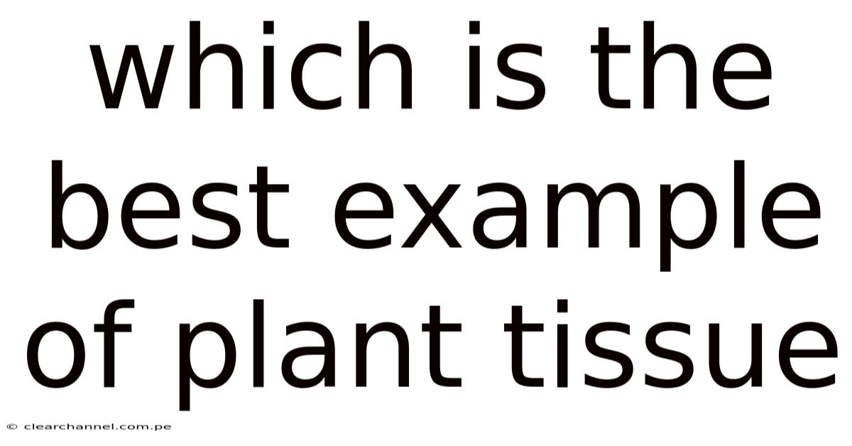 Which Is The Best Example Of Plant Tissue